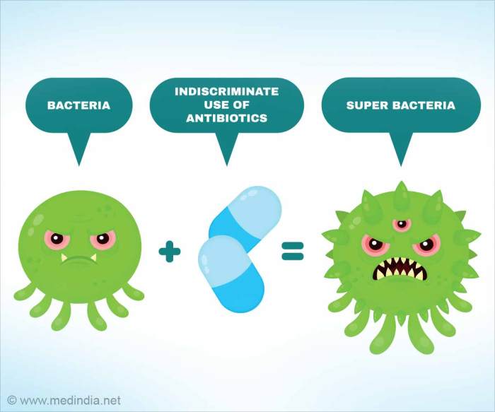 Antibiotic bacteria antibiotics antibiotikaresistenz bacterial gonorrhea germs infection sepsis types complicating